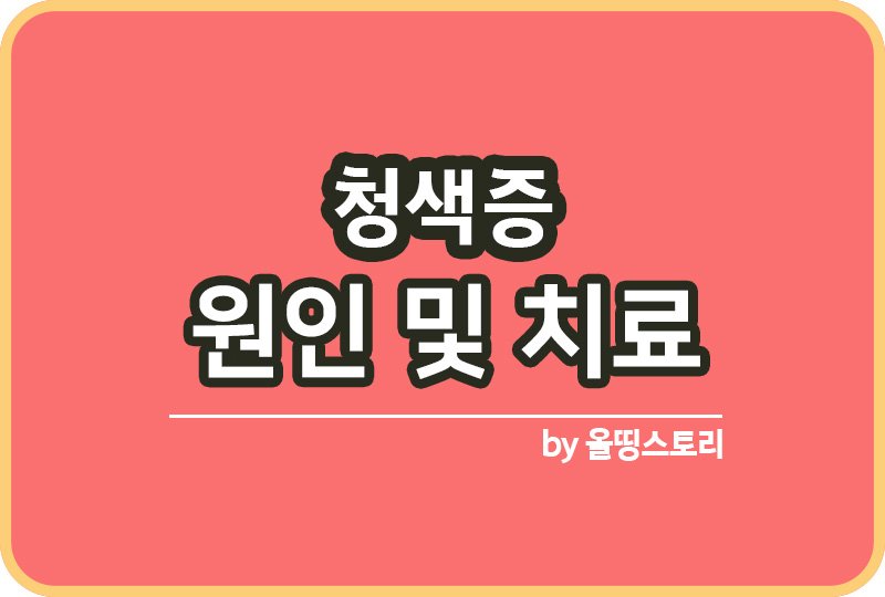 ㄴ미아른림늘