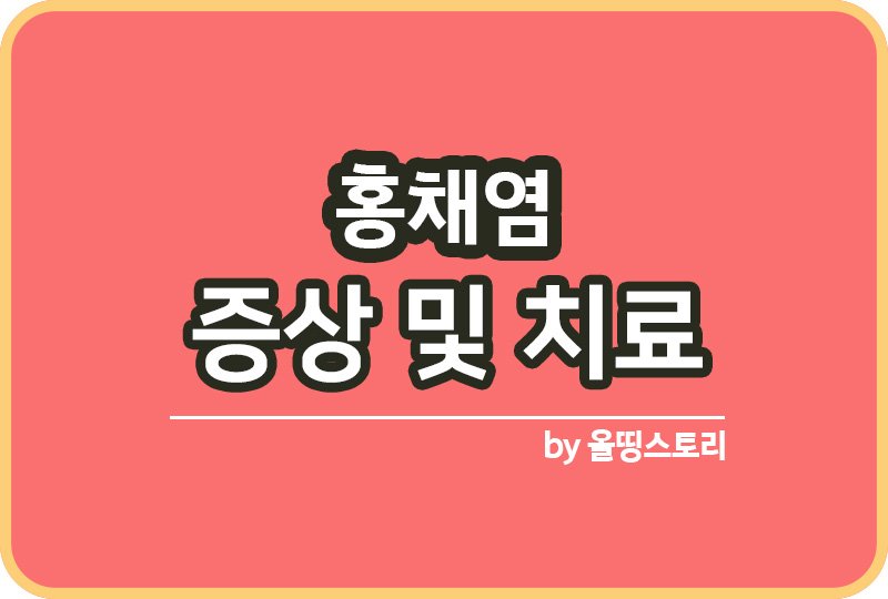 올띵스토리썸네일(낫띵)-복사ㄹ미나ㅡㄹㄴ음ㄹㄴㄹ